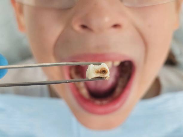 Best Emergency Dental Care for Sports Injuries in Farmville, NC